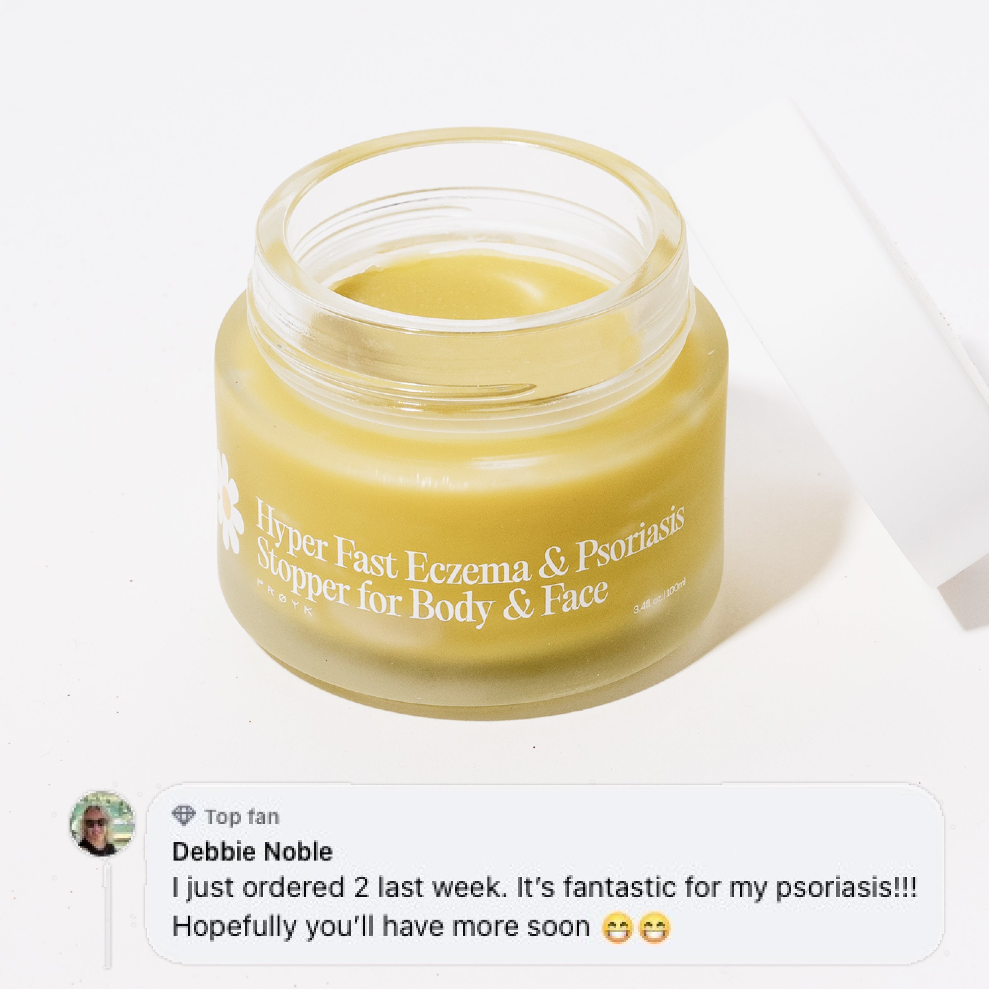 Frøya Organics Ultra-Fast Relief Balm in glass jar with lid – eczema and psoriasis balm front view