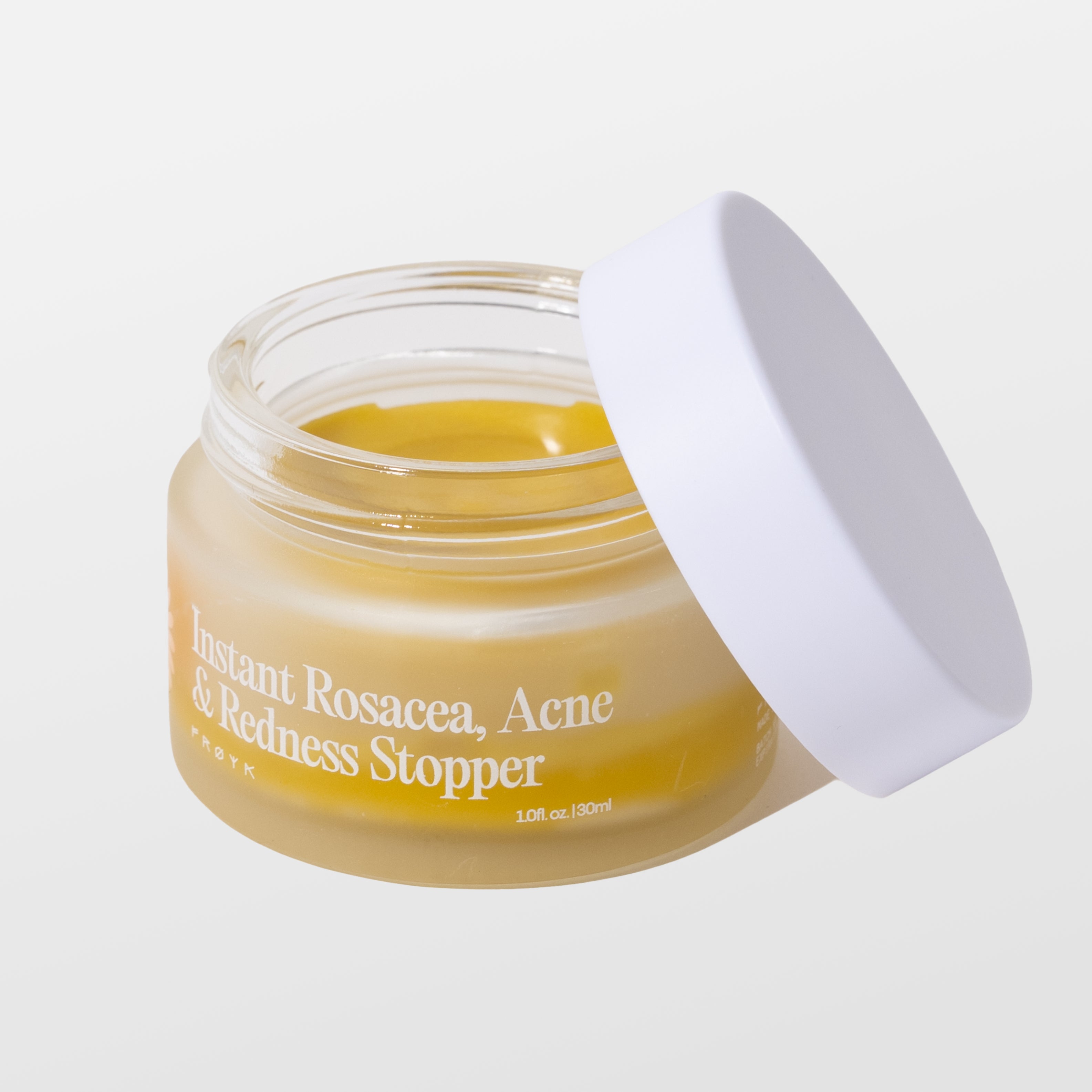 Frøya Organics Instant Rosacea, Acne & Redness Stopper in glass jar with lid – organic rosacea balm front view