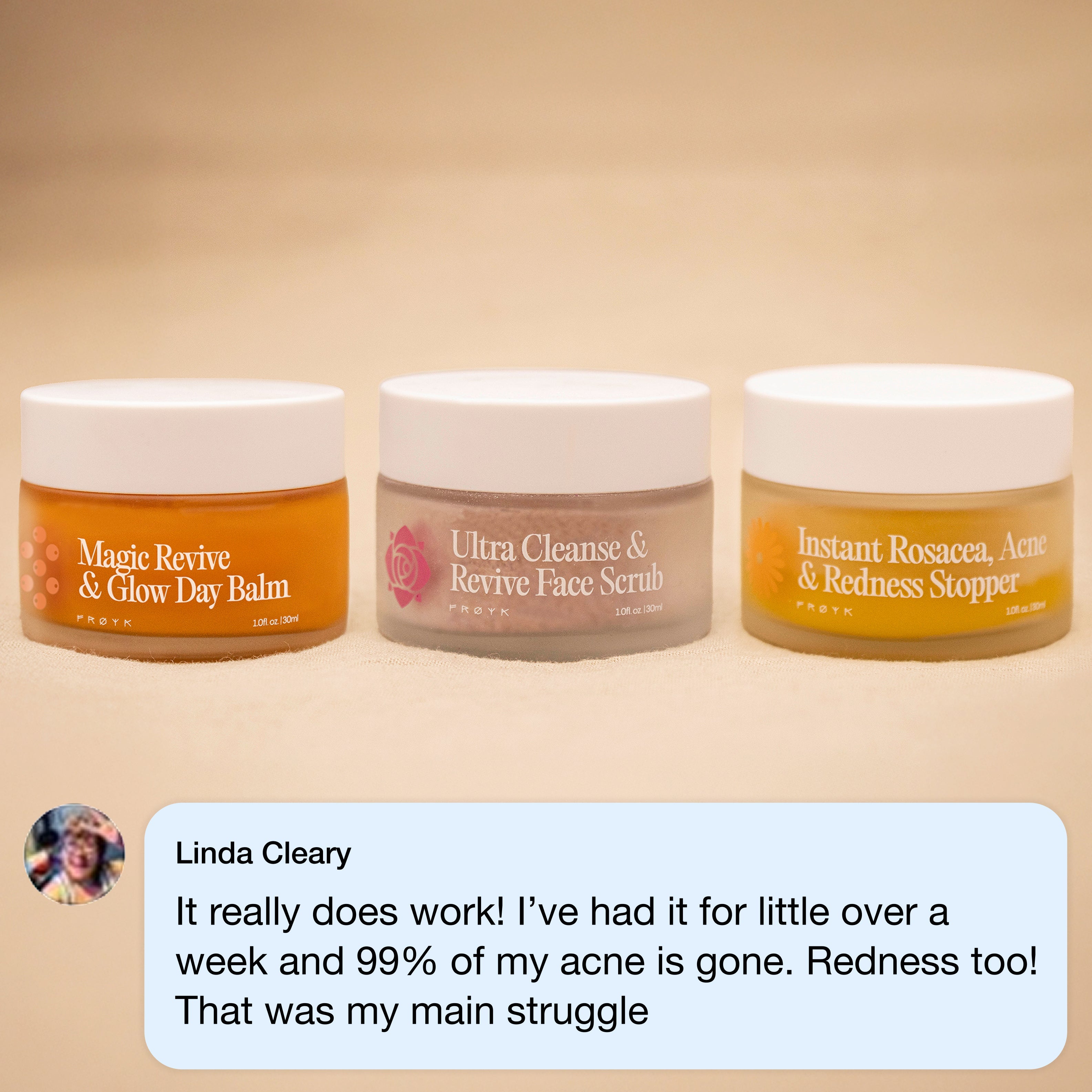 Frøya Organics Complete Acne System for Women in glass jar with lid – 4-step acne system front view